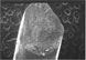 Fatigue Fracture of MP35N